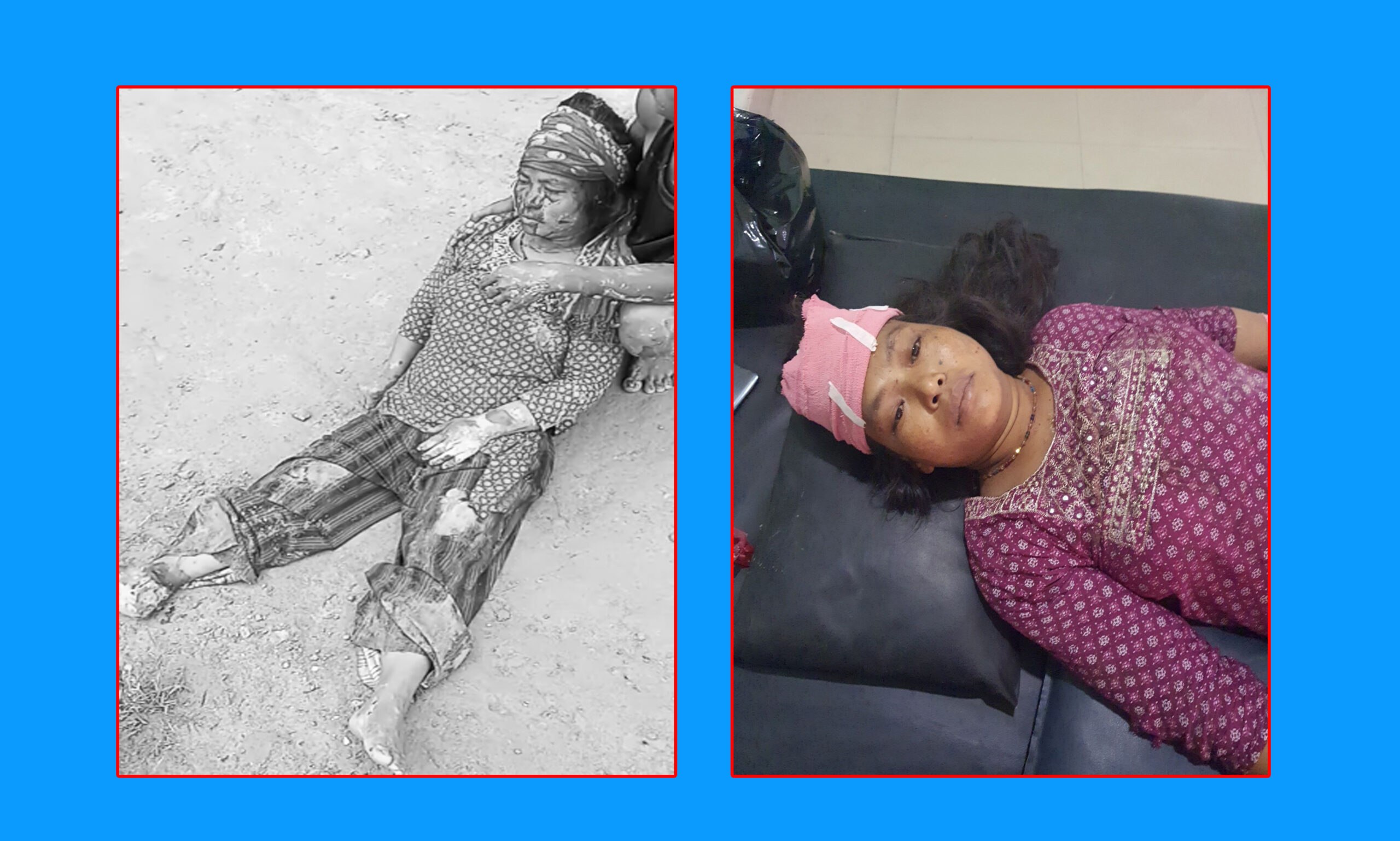 हरिहरपुरगढीमा पहिरोमा परि एक महिला घाइते,उपचार हुदै